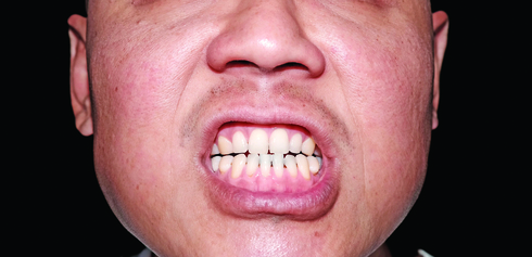 נשך ואיים על חייה